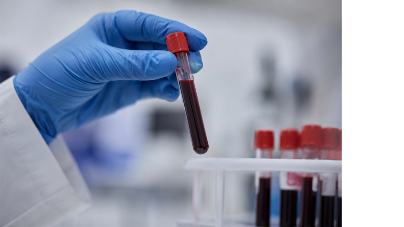 Blood in vials